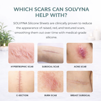 Solvyna™ Silicone Sheets