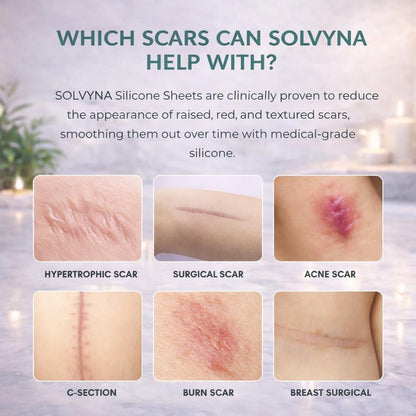 Silicone Scar Sheets